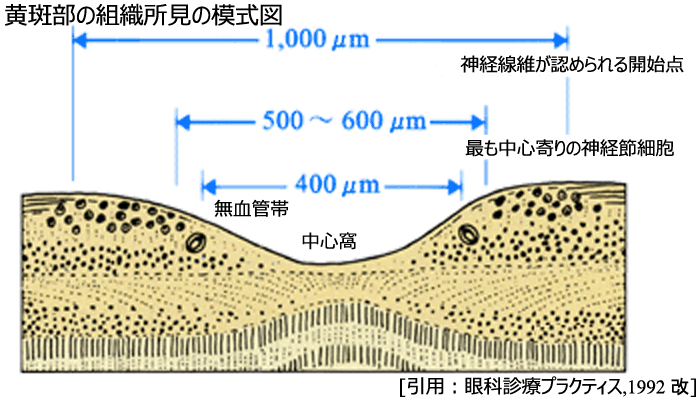 図 14