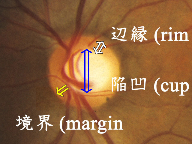 図 06