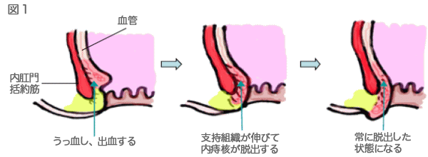 図1