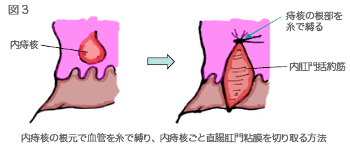 図3