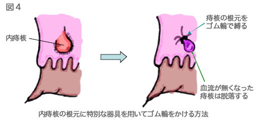 図4