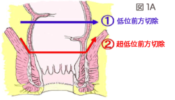 図1A