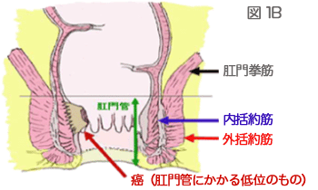 図1B