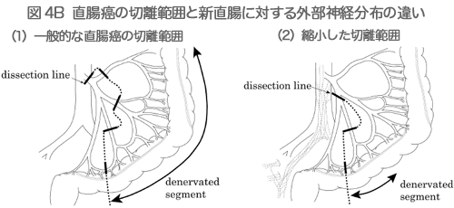 図4B