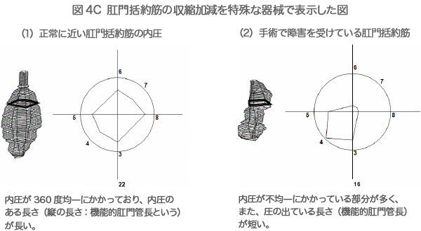 図4C