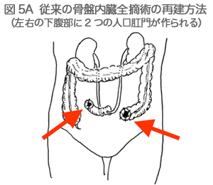 図5A