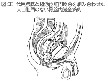 図5B