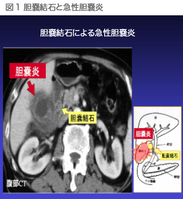 図1
