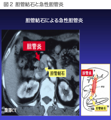 図2