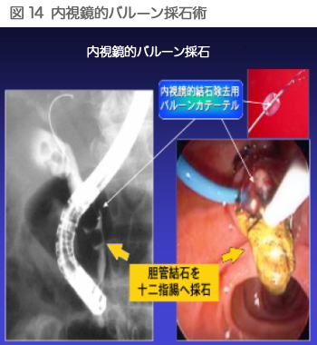 図14