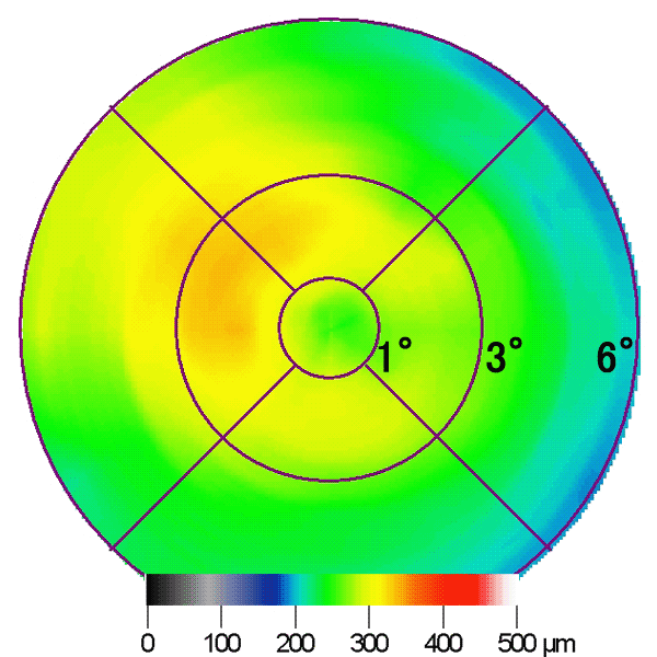 図 14 網膜厚