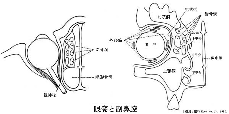 図 12