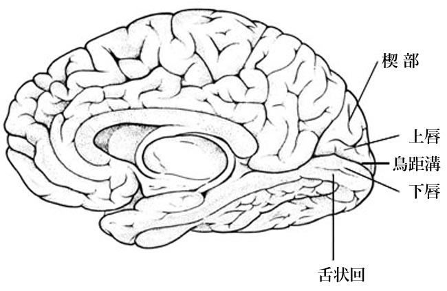 図 14