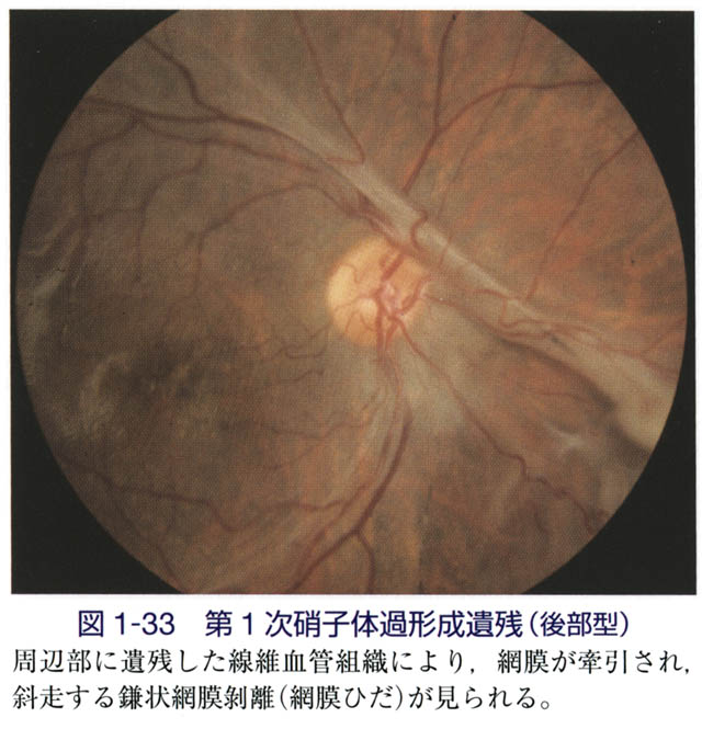 図 補 自然治癒