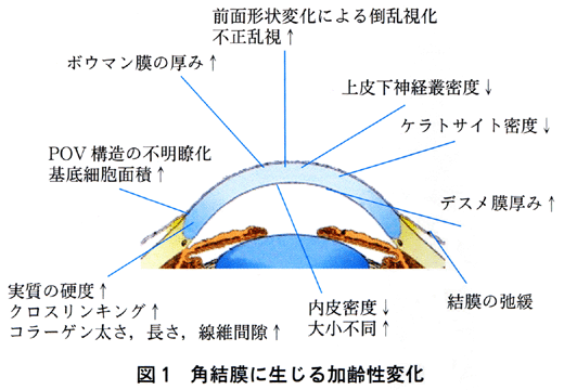 図 17