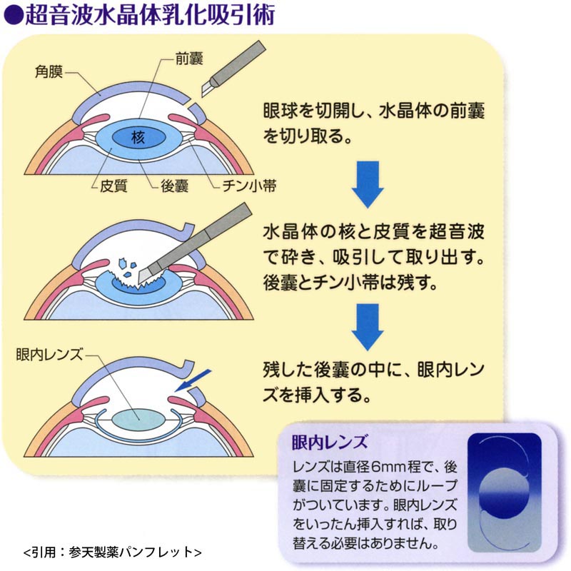 図 22 手術