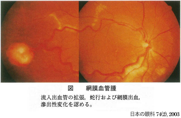 図 21