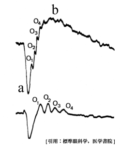 図 03 網膜電図