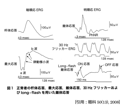 図 08 網膜電図