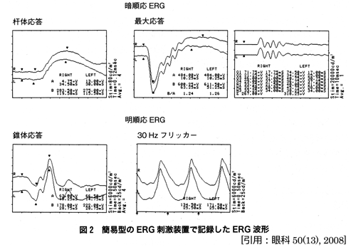 図 09 網膜電図