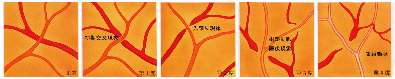 図 02