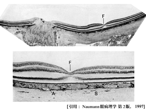 図 17