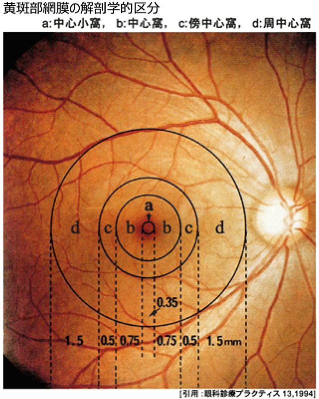 図 44 黄斑
