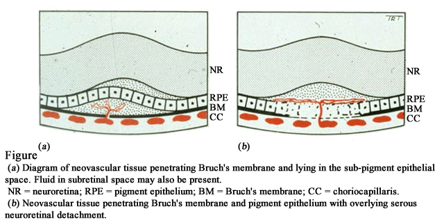 図 13