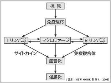 図 05 scleritis