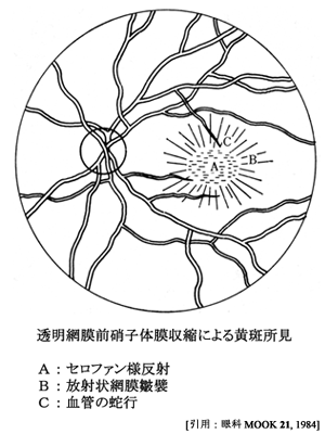 図 11 cellophane