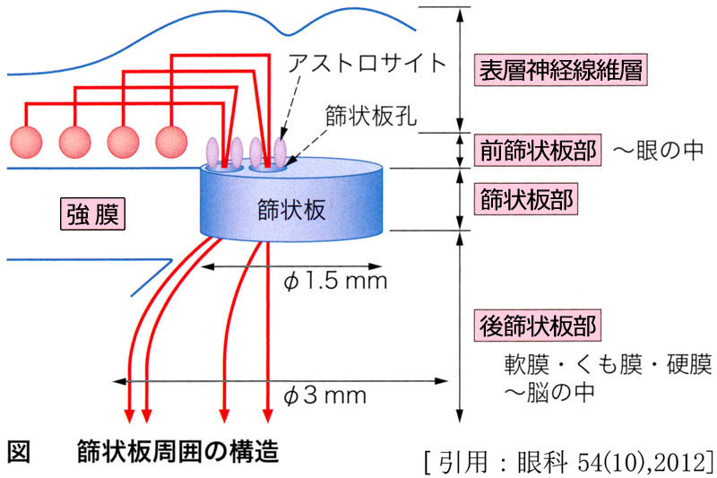 図 14