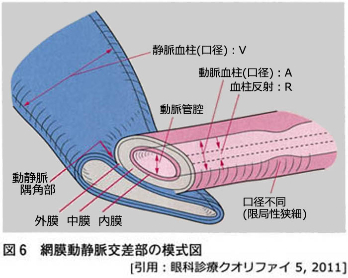 図 25