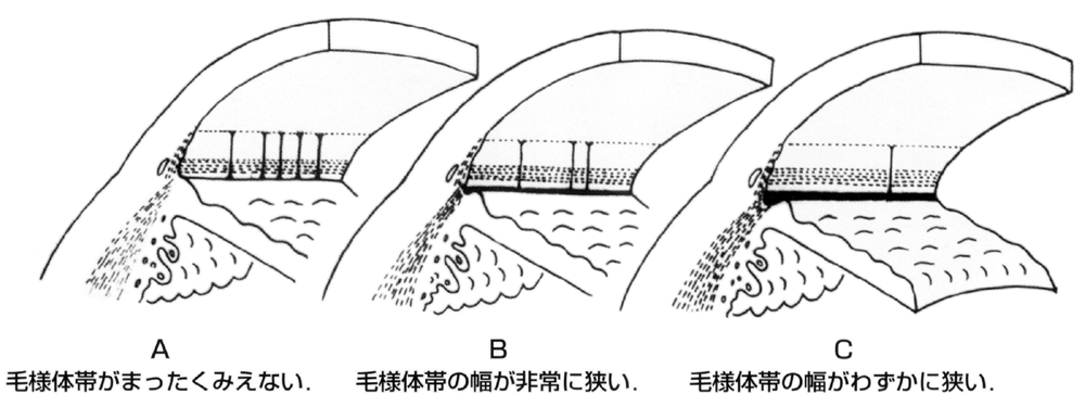 図12