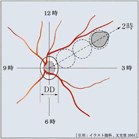 図 08 乳頭径