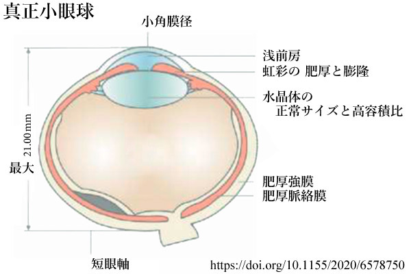 図 01 真正小眼球