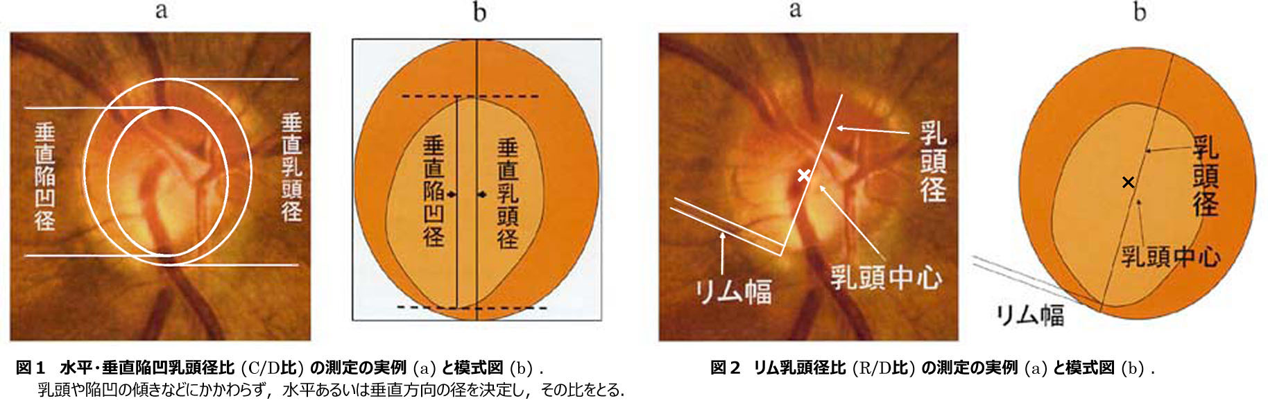 図 1・2