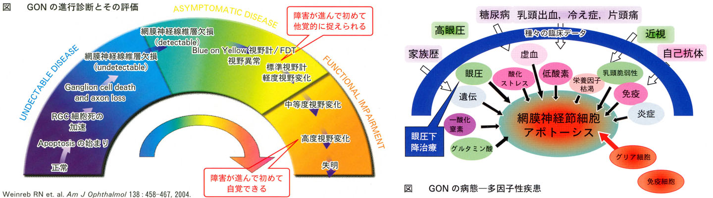 図 17 GON