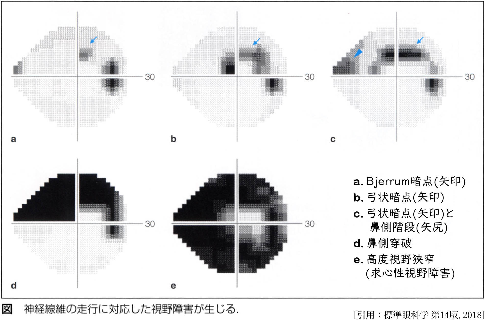 図 補 Humphrey