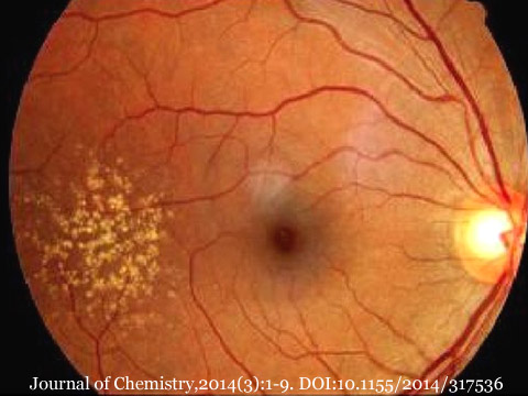 図 59 どるーぜん補
