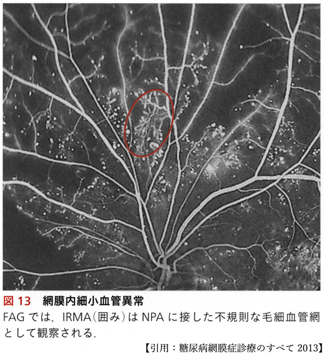 図 補