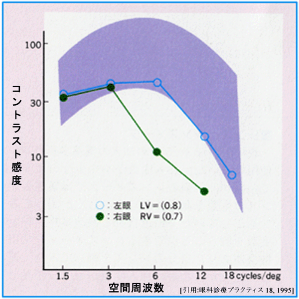 図 17 コントラスト感度