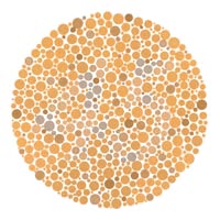 39 第二異常