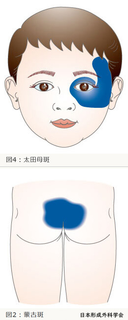図 補