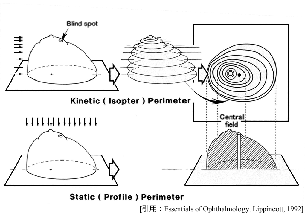 図02 Kinetic_Static