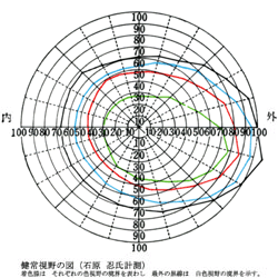 図04 色視野