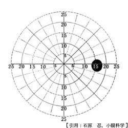 図05 盲点