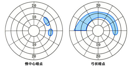 図04 ブエルム