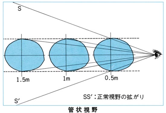 図09 管状視野