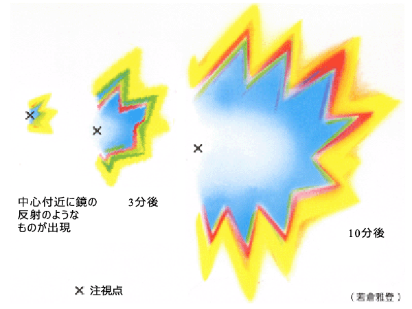 図 05 閃輝暗点