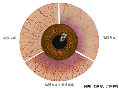 図 01 充血